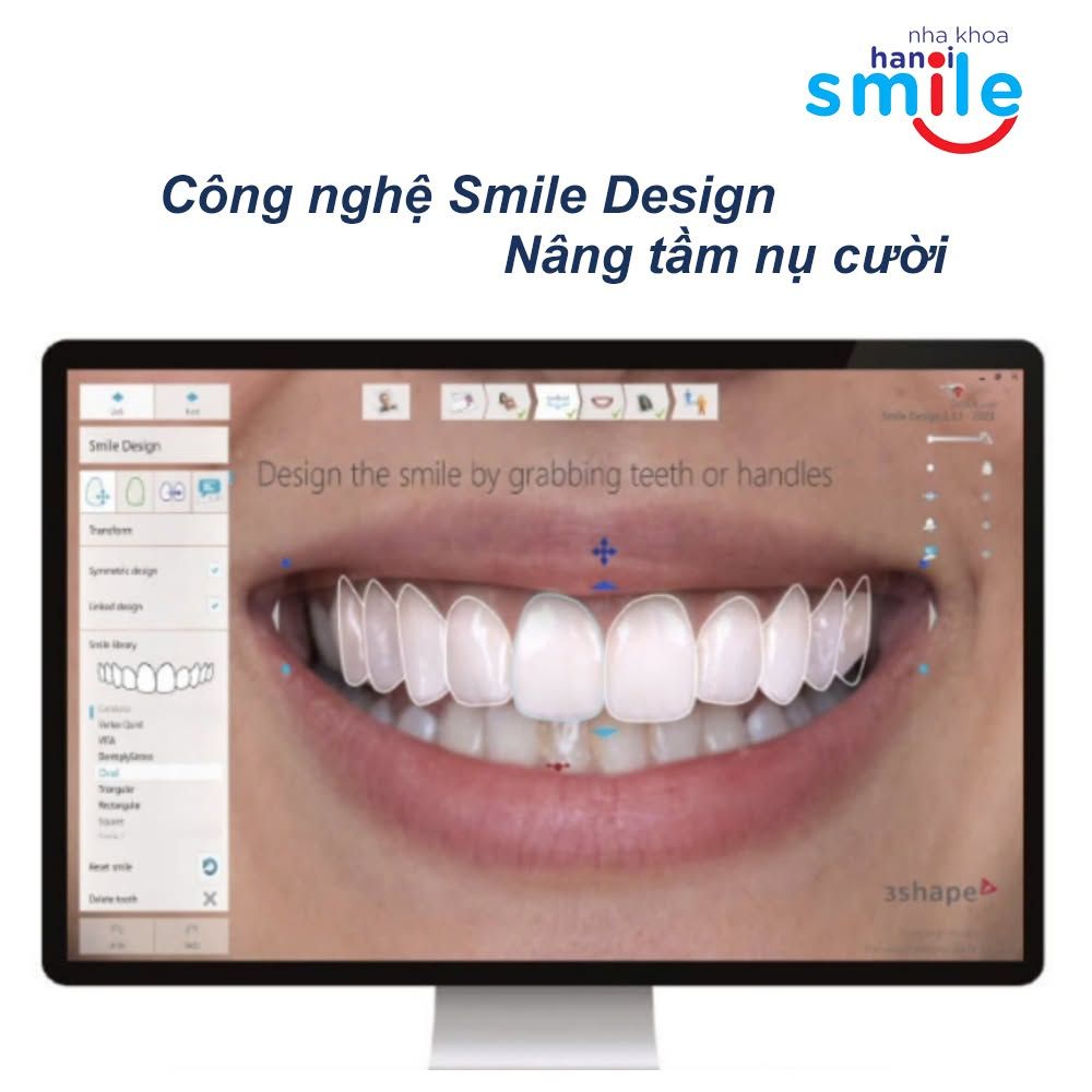 Phần mềm Smile Design mô phỏng nụ cười trước điều trị